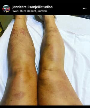 Jennifer Ellison Nude  Leaks 3 Photos