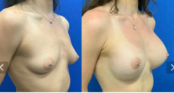 Taylor Stewart Nude  Leaks 20 Photos