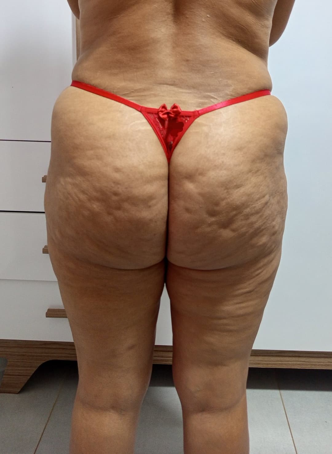 Bundona da esposa com celulite