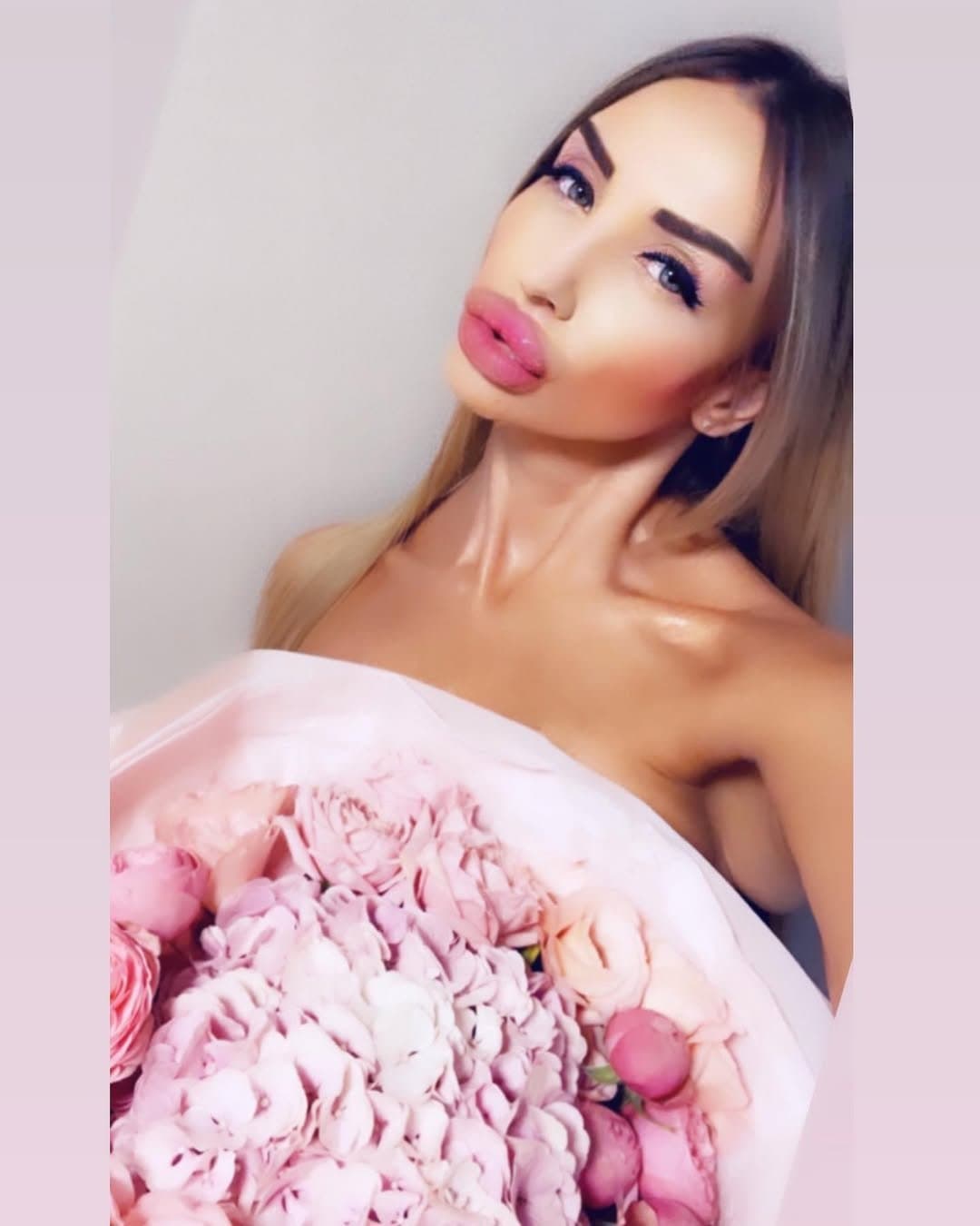 Huge Bimbo Duck Lips