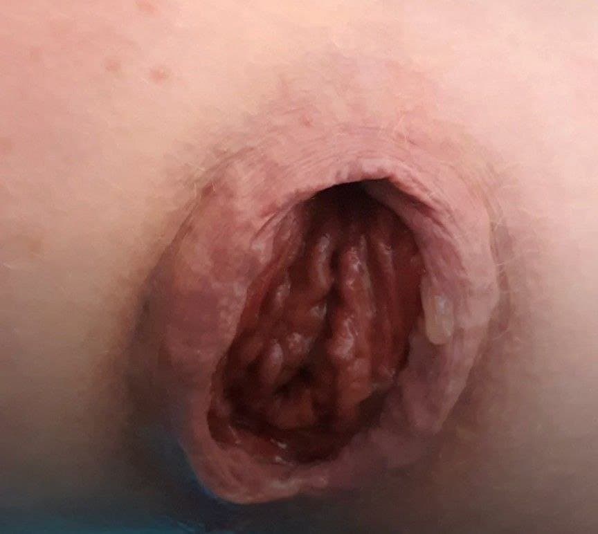 @Jamez18 Showing of their ruined stretched hole and their  small clit and fat ass