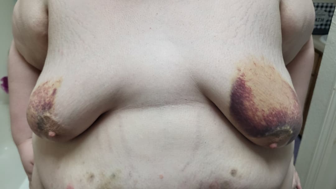 Heavy BDSM Brusing Over A Week