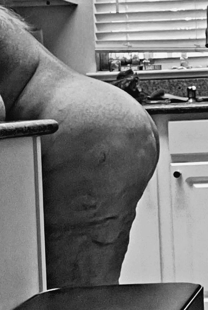 Old Women (001): A Old Naked Sunshine