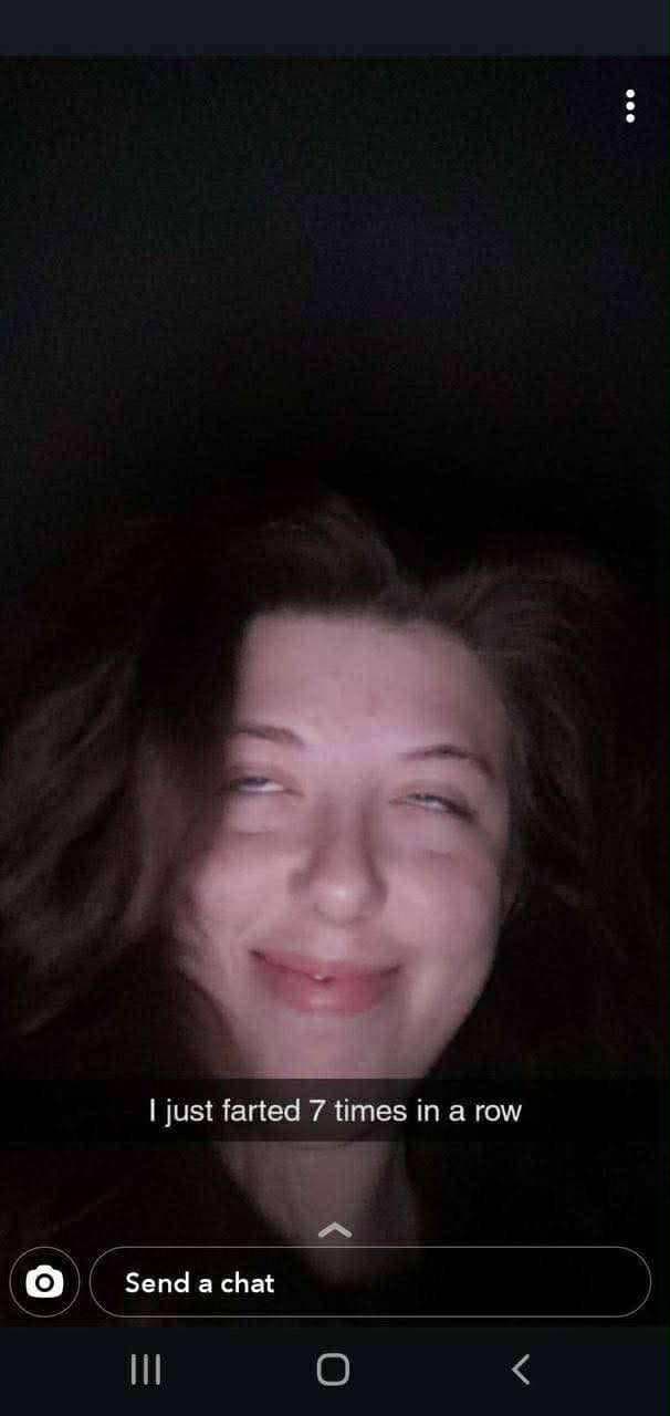 Brace face and her fart dispenser she loves to fart out of