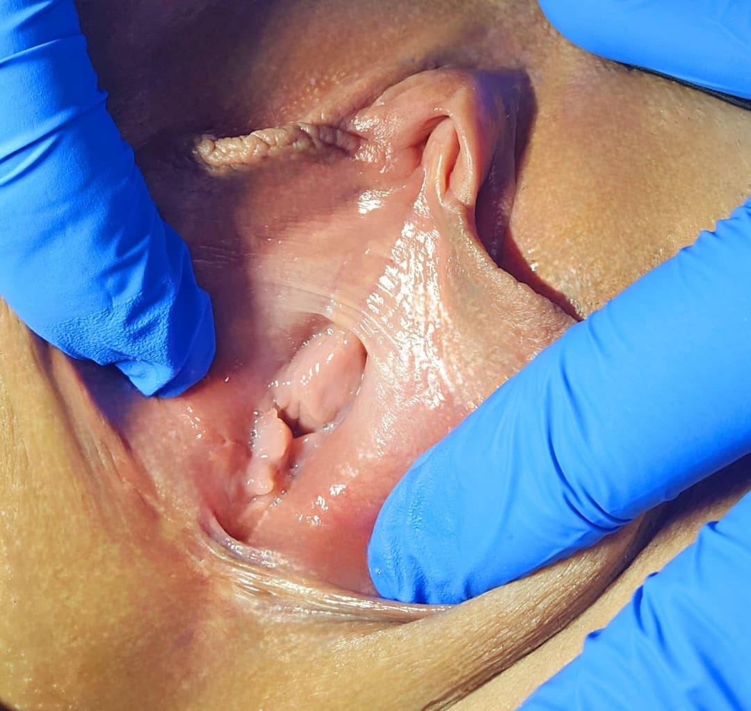 Click to view full size Charlotte spreading her meaty swollen pussy hole. Her KIK: LickMySwollenPus