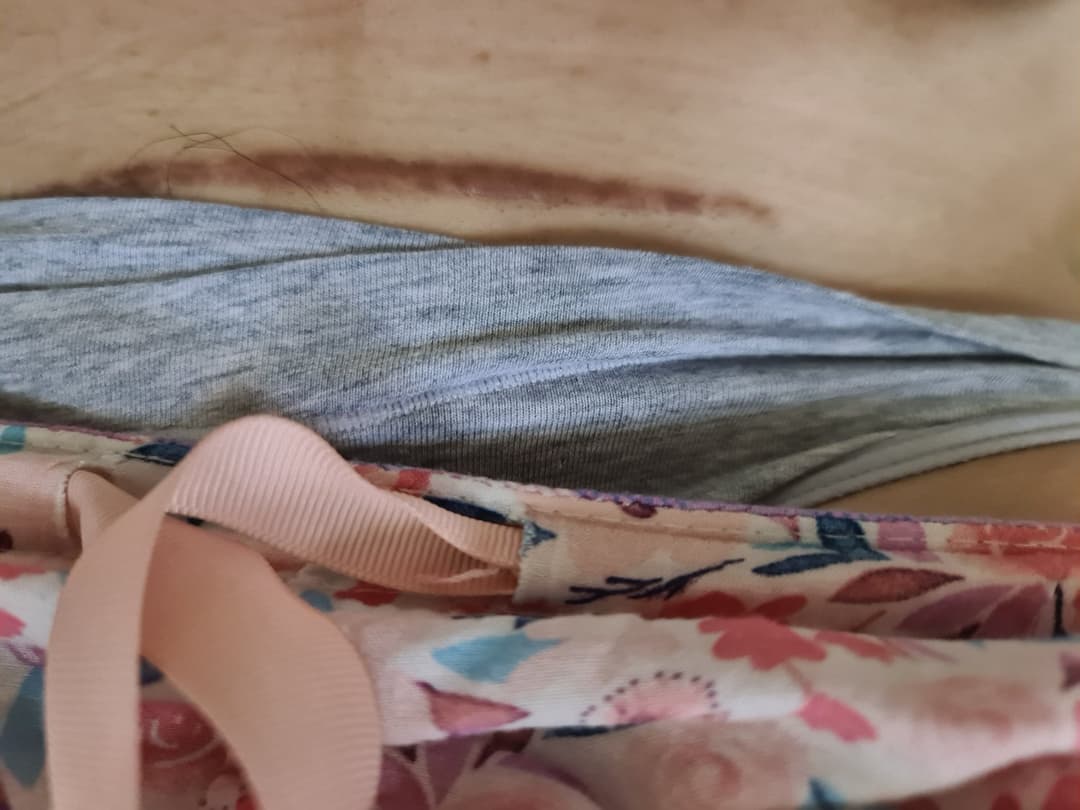 Marilú Bastida, puta embarazada