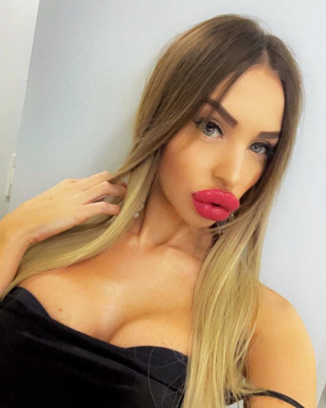 Huge Bimbo Duck Lips