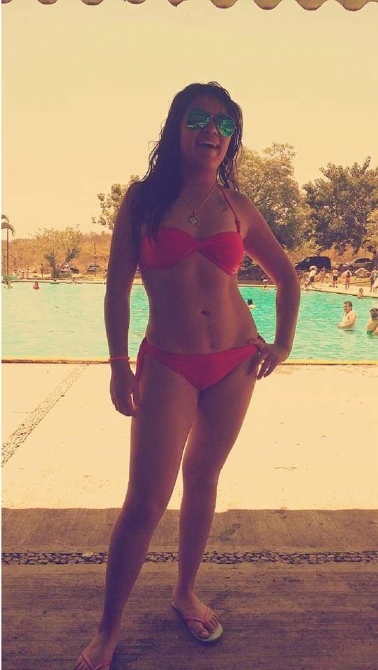 Ana ex alumna de la Unitec Campus Sur quemada por su esposo