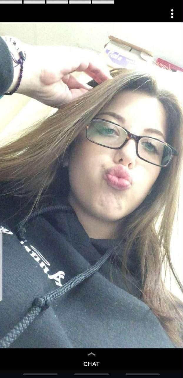 Brace face and her fart dispenser she loves to fart out of