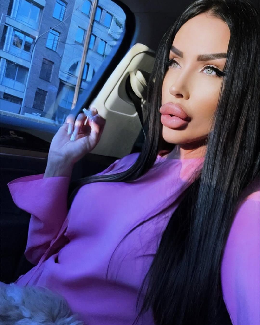 Huge Bimbo Duck Lips