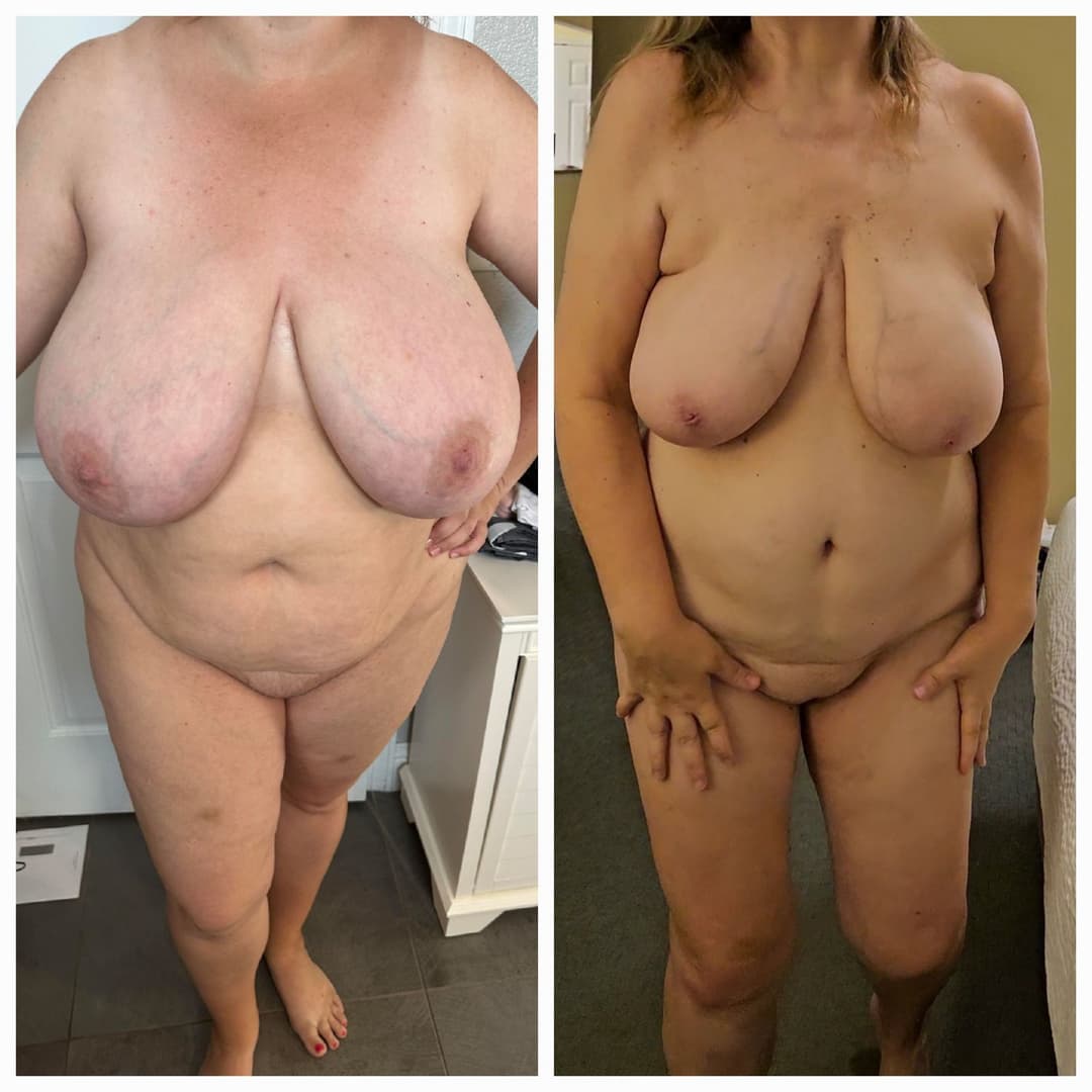 Side by side comparison