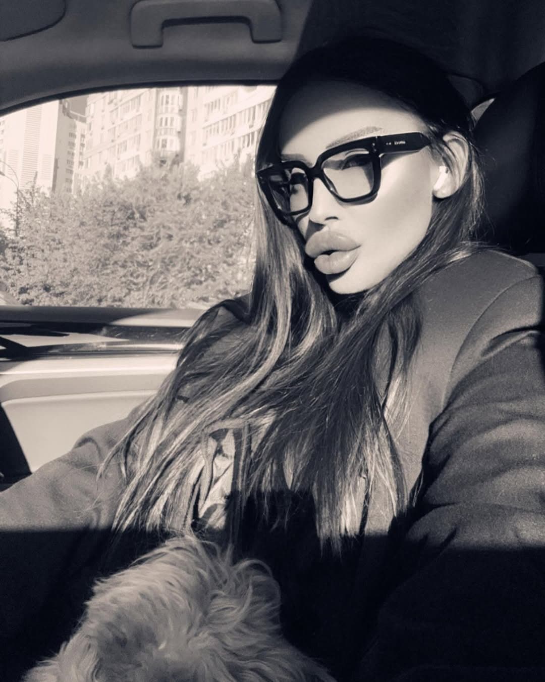 Huge Bimbo Duck Lips