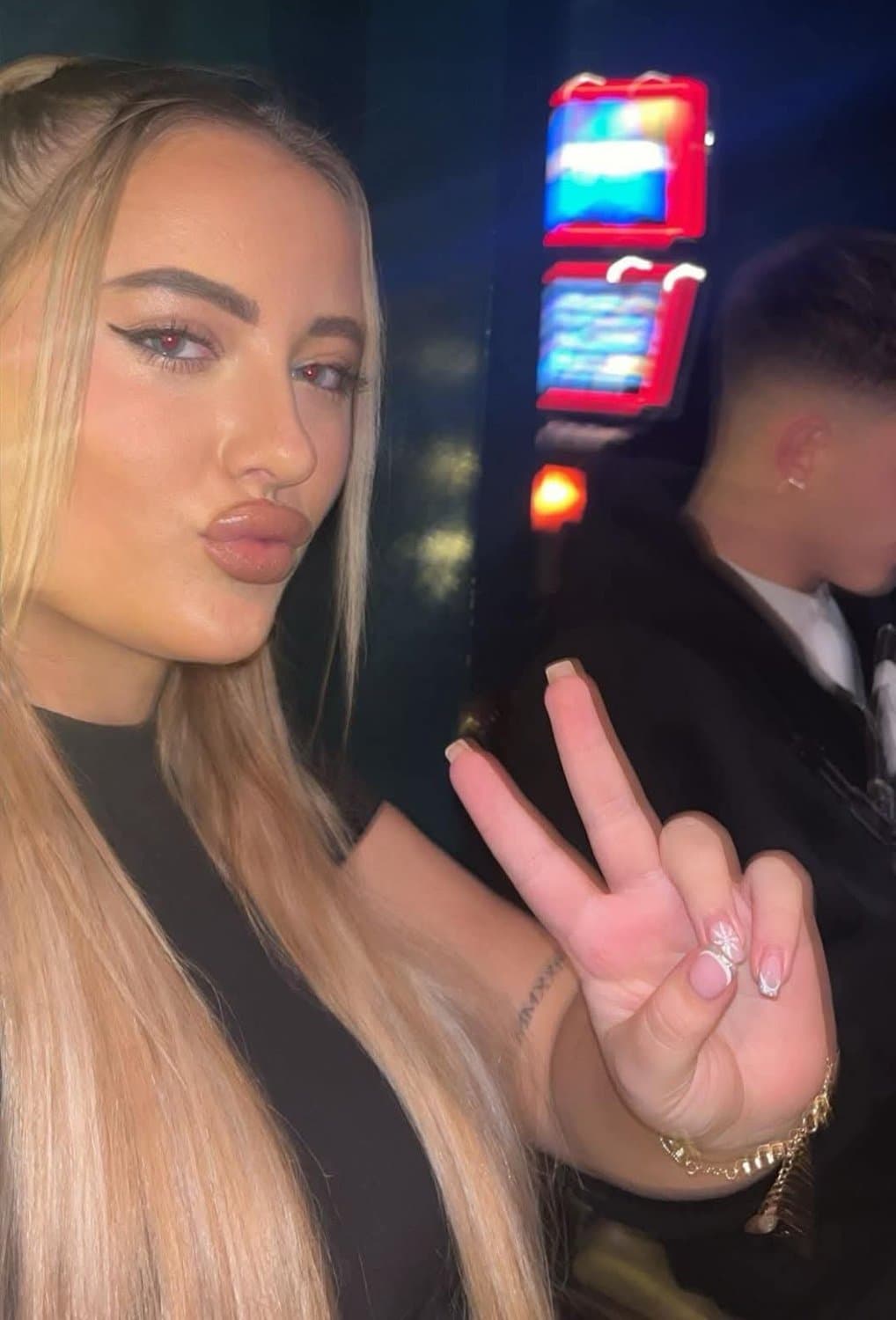 This Chav Chloe told the practitioner, "give me the deluxe ultra suction nut extractor cock lips"