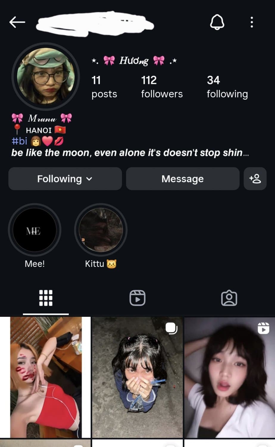 Viet Asian Teen Pronebone