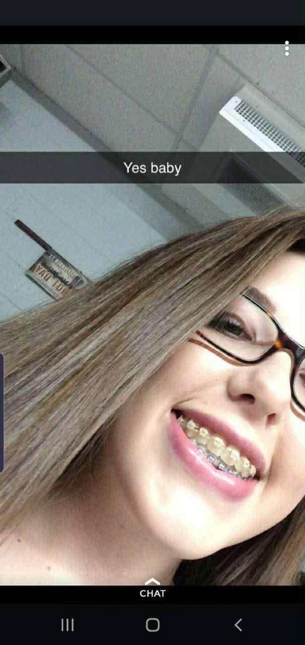 Brace face and her fart dispenser she loves to fart out of