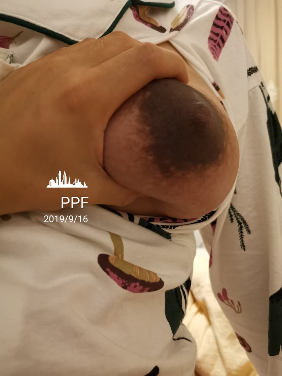 Huge areolas on huge preggo tits - ddɟƖϛㄥƖϛㄥ