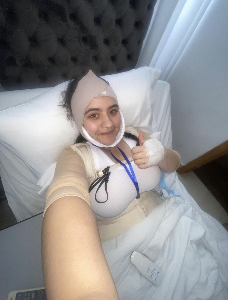 18 yr old bimbofied herself with insane BBL and breast implants