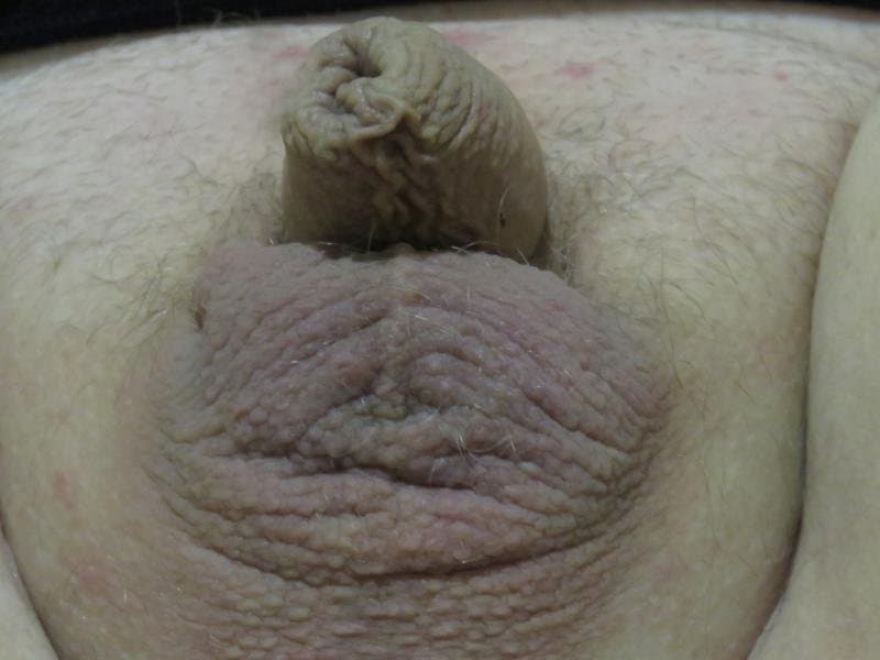 Shrinking small dick!