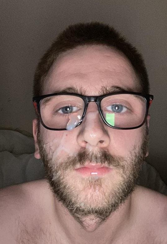 self facial aftermath