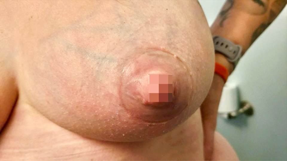 Titties......Censored