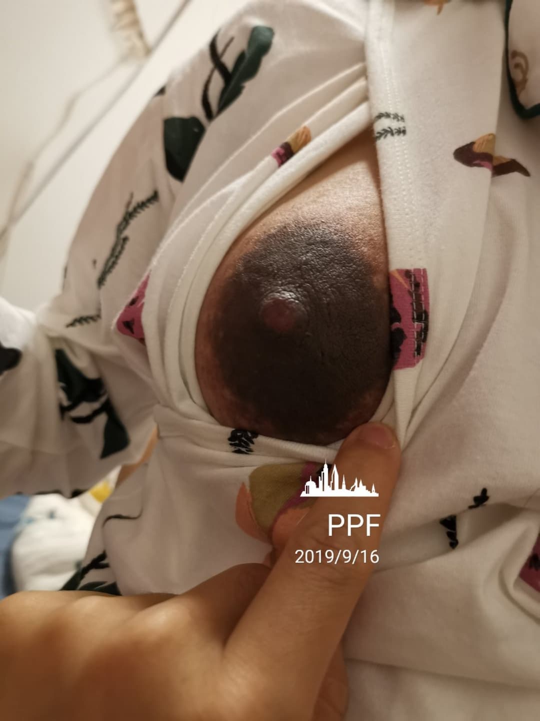 Huge areolas on huge preggo tits - ddɟƖϛㄥƖϛㄥ