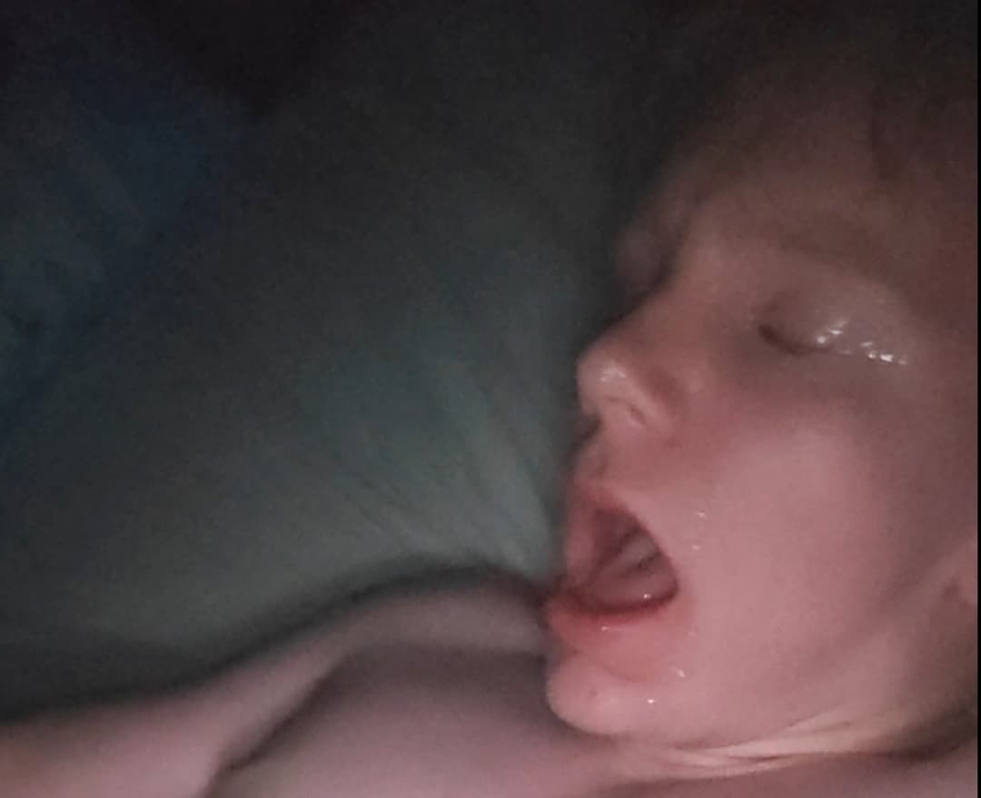 Big selffacial on my own teen boy face:)