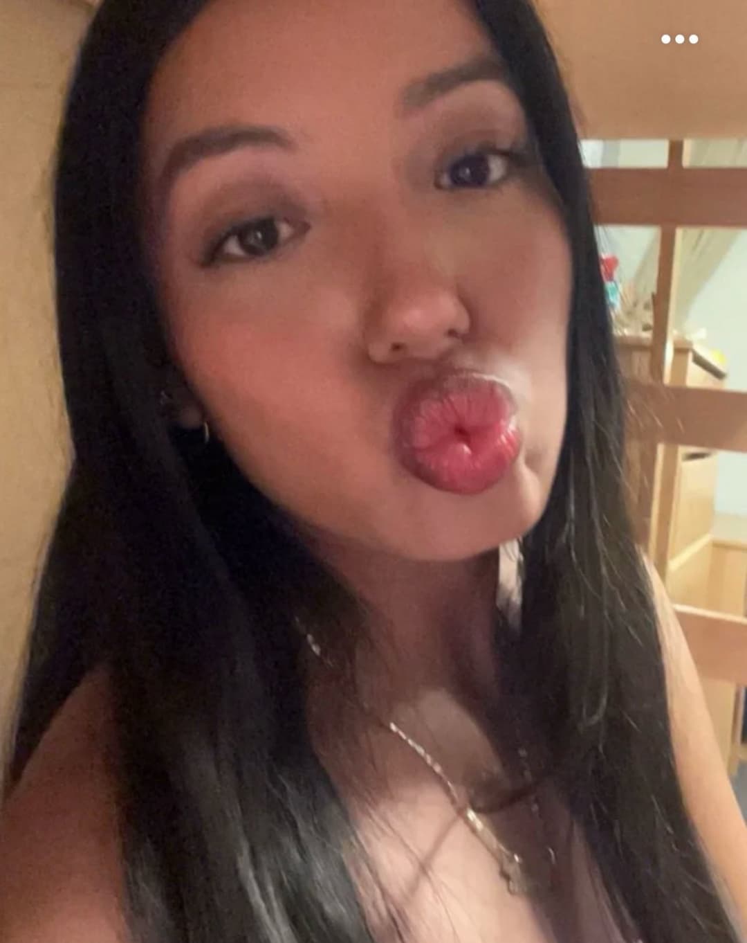 Duck lips pouting teens dsl