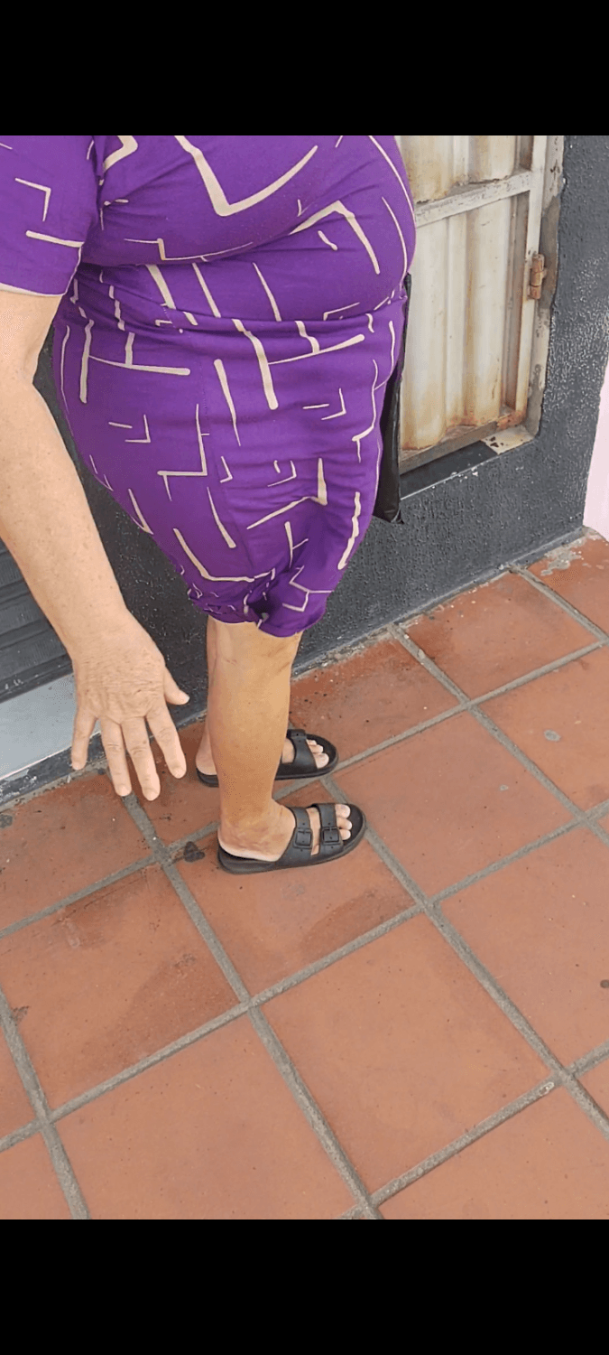 Encoxada, tapa no bundão