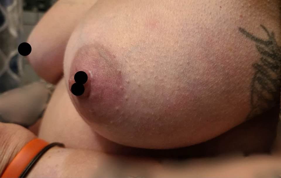 Titties......Censored