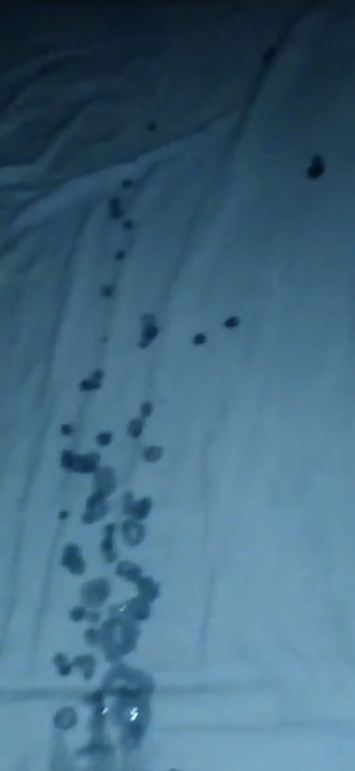 Casada gozando gostoso no motel. Esposa era chupada e levando 3 dedos na buceta , escute os gemidos.