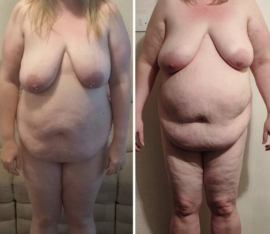 Fat saggy bbw weight gain