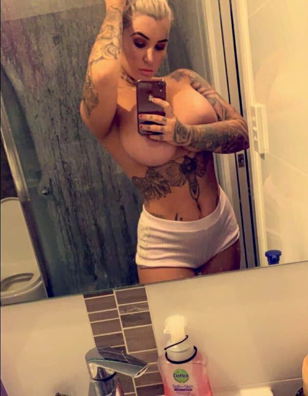 Botched Breast Implants, ??????? ????? Should Sue Her Surgeon