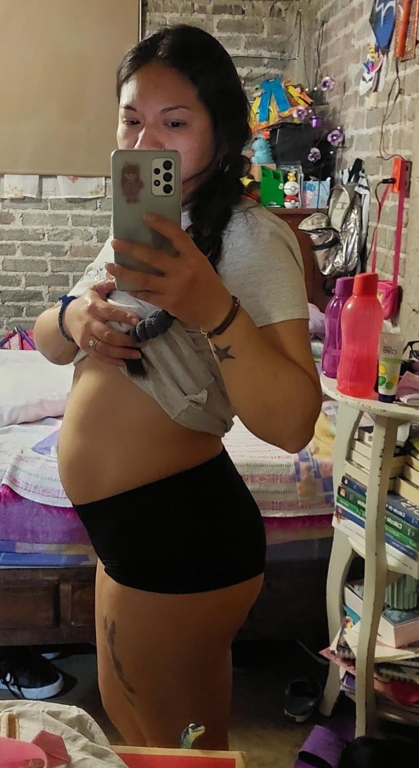 Ana ex alumna de la Unitec Campus Sur quemada por su esposo