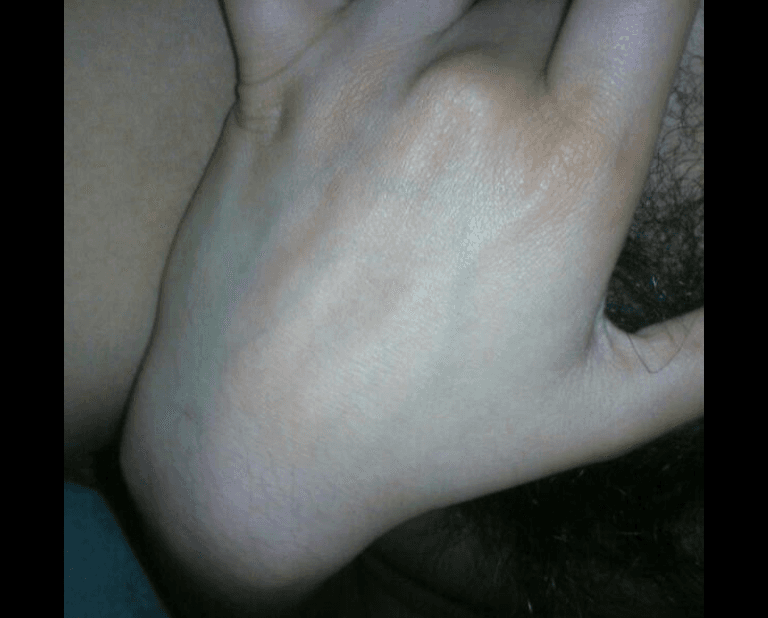 Rebeca ex alumna del IPN (UPIICSA) quemada por el ex