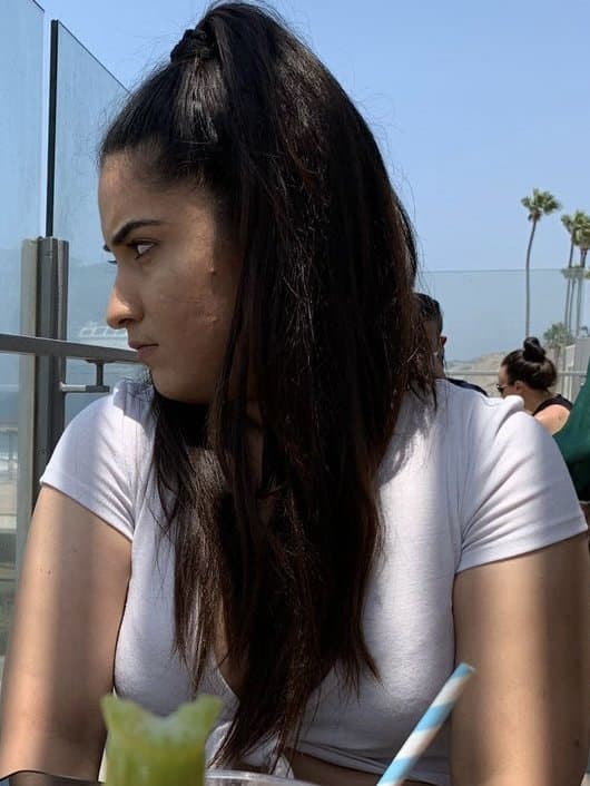 AFGHANI STREET DOG ZUHAL WITH STINKY ASS