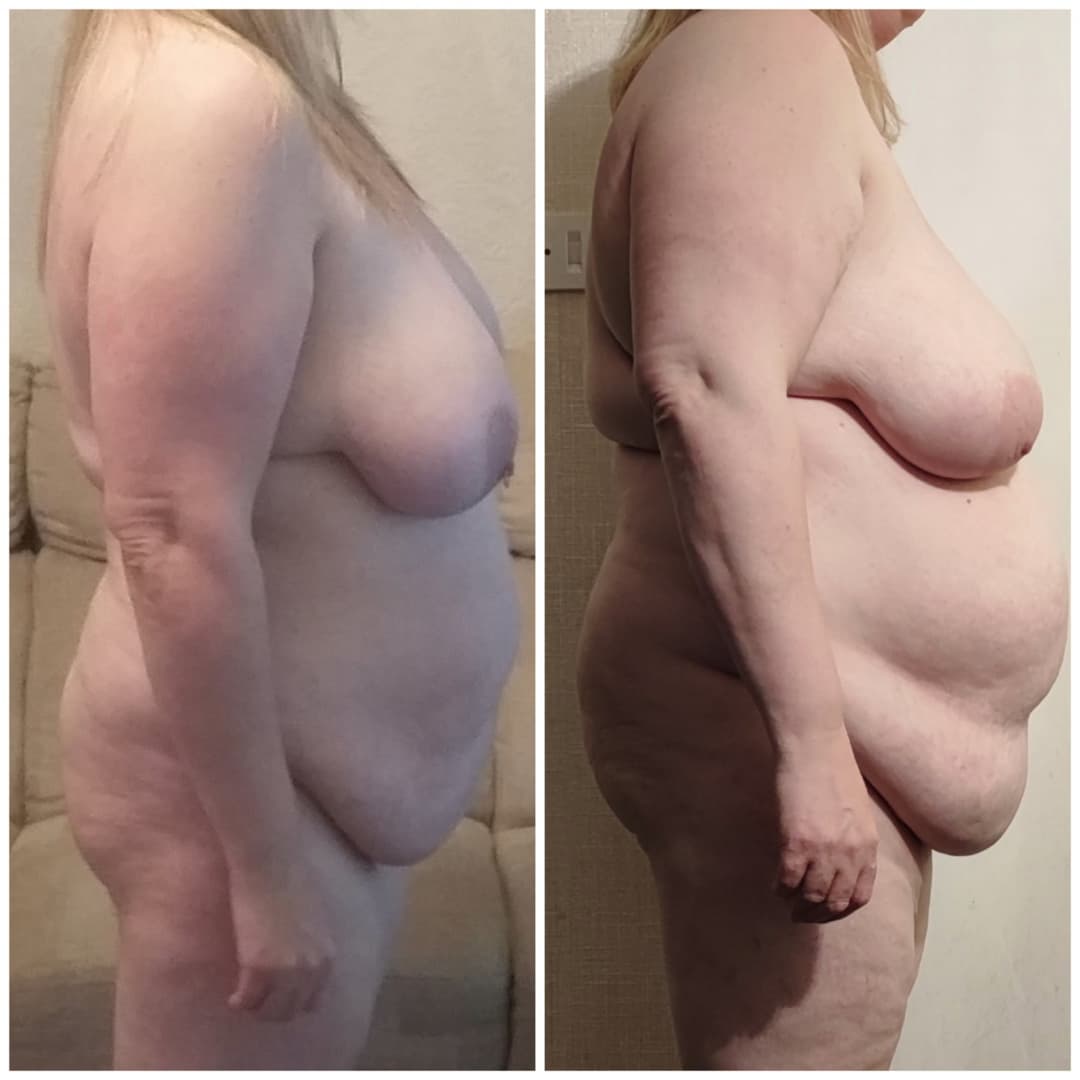 Fat saggy bbw weight gain