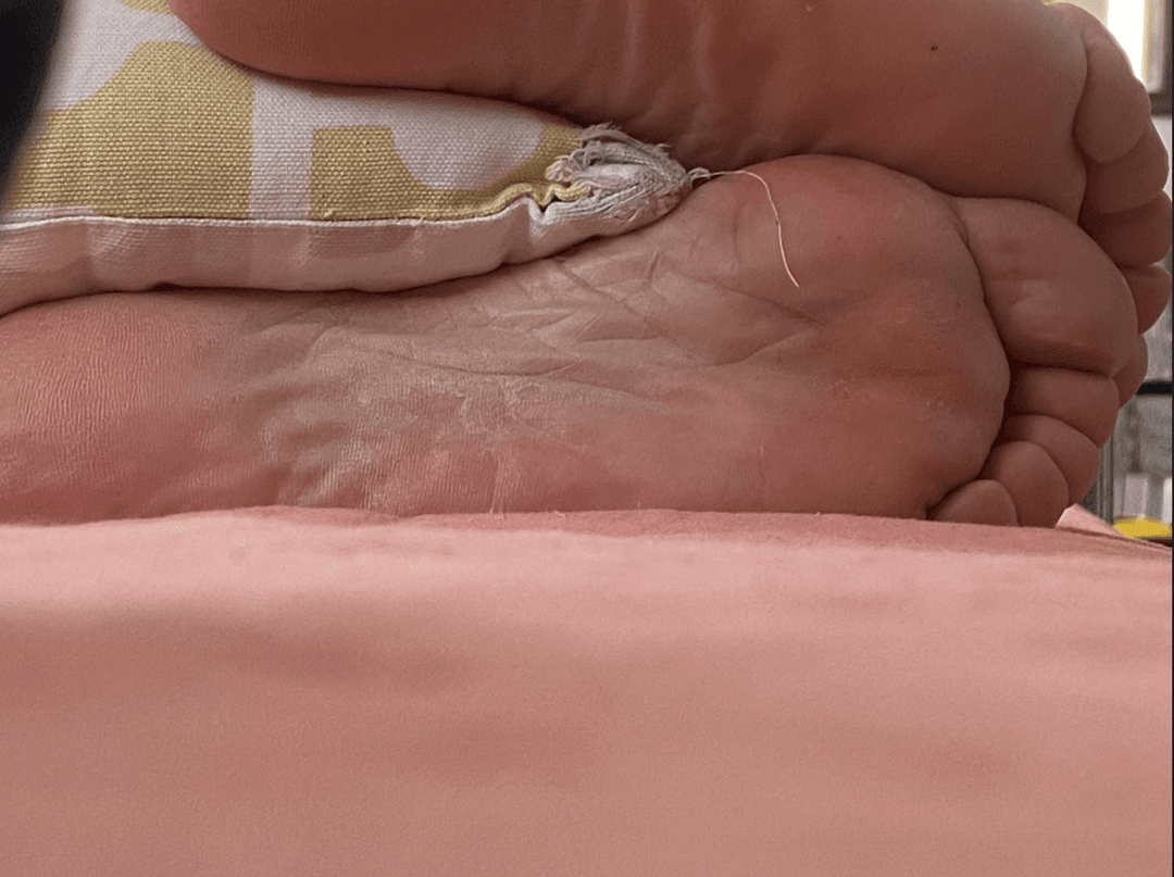 My moms candid feet/soles