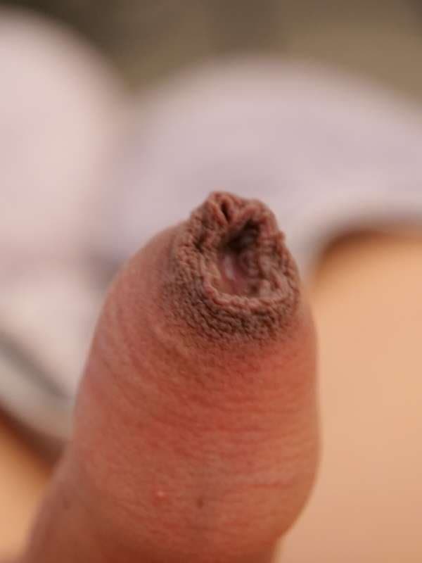 Click to view full size Cute Femboy girl foreskin close up