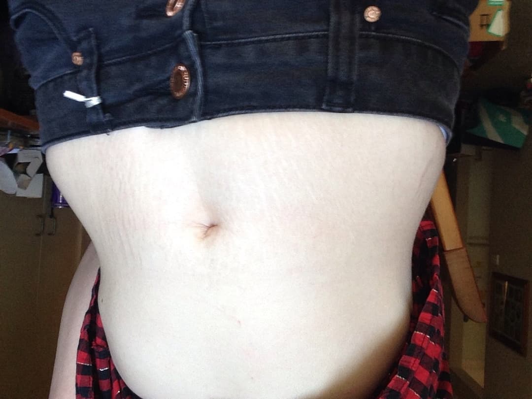 Emily scuderi aka twixie scuderi aka twixiepuppy old nude pics part 2