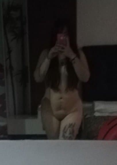 Ana ex alumna de la Unitec Campus Sur quemada por su esposo