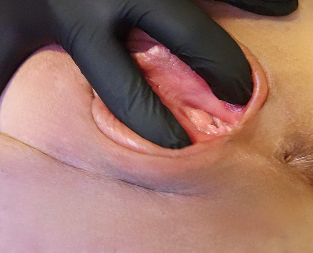 Click to view full size Charlotte spreading her meaty swollen pussy. Her KIK: LickMySwollenPus