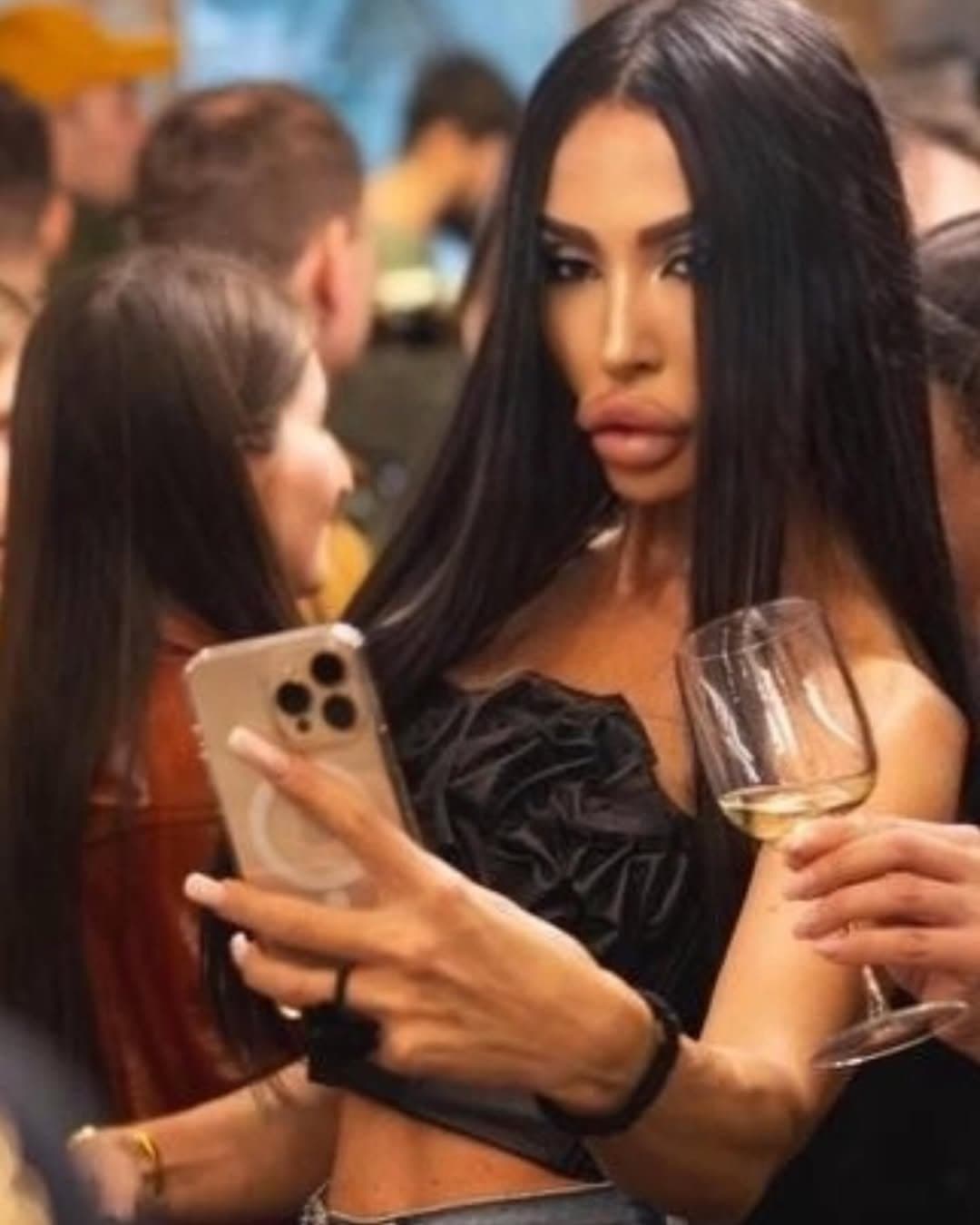 Huge Bimbo Duck Lips