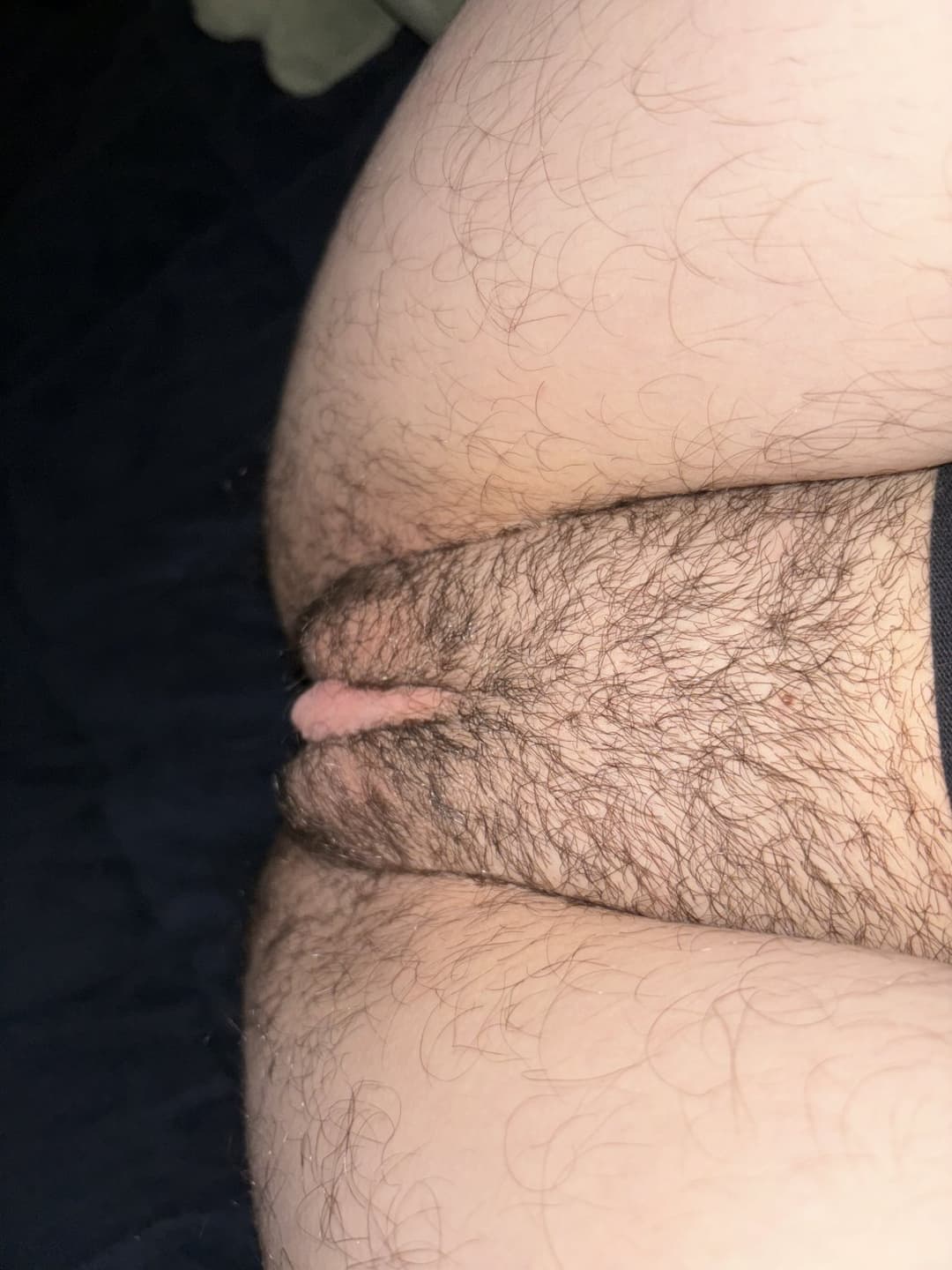 what would you do to my teen ftm holes?