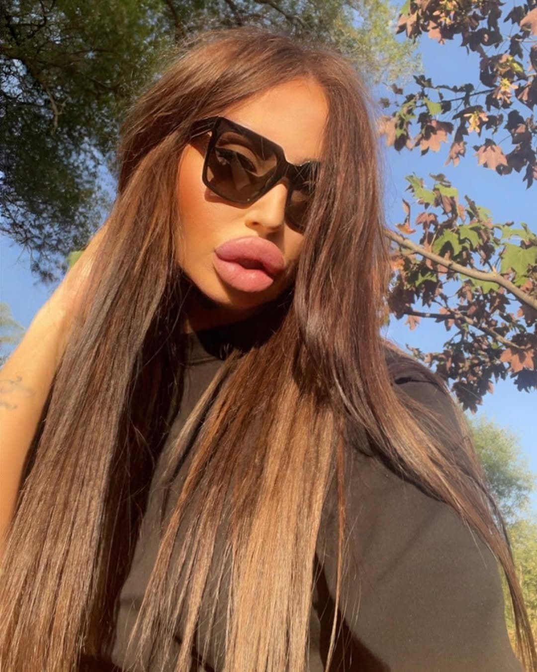 Huge Bimbo Duck Lips