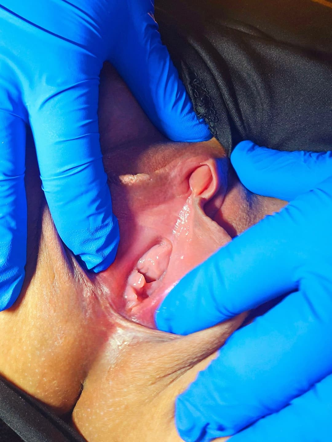 Charlotte spreading her meaty swollen pussy. KIK: LickMySwollenPus