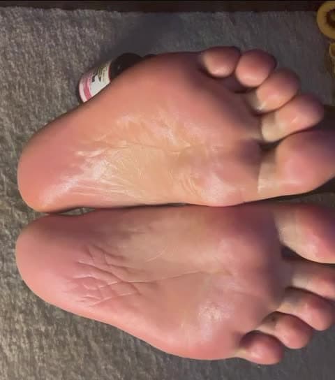 Sexy feet on feet finder “Crustytoegoddess”