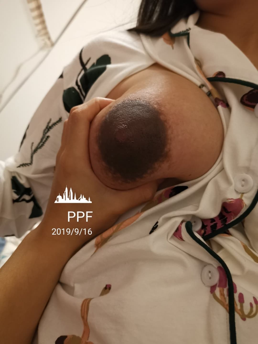 Huge areolas on huge preggo tits - ddɟƖϛㄥƖϛㄥ