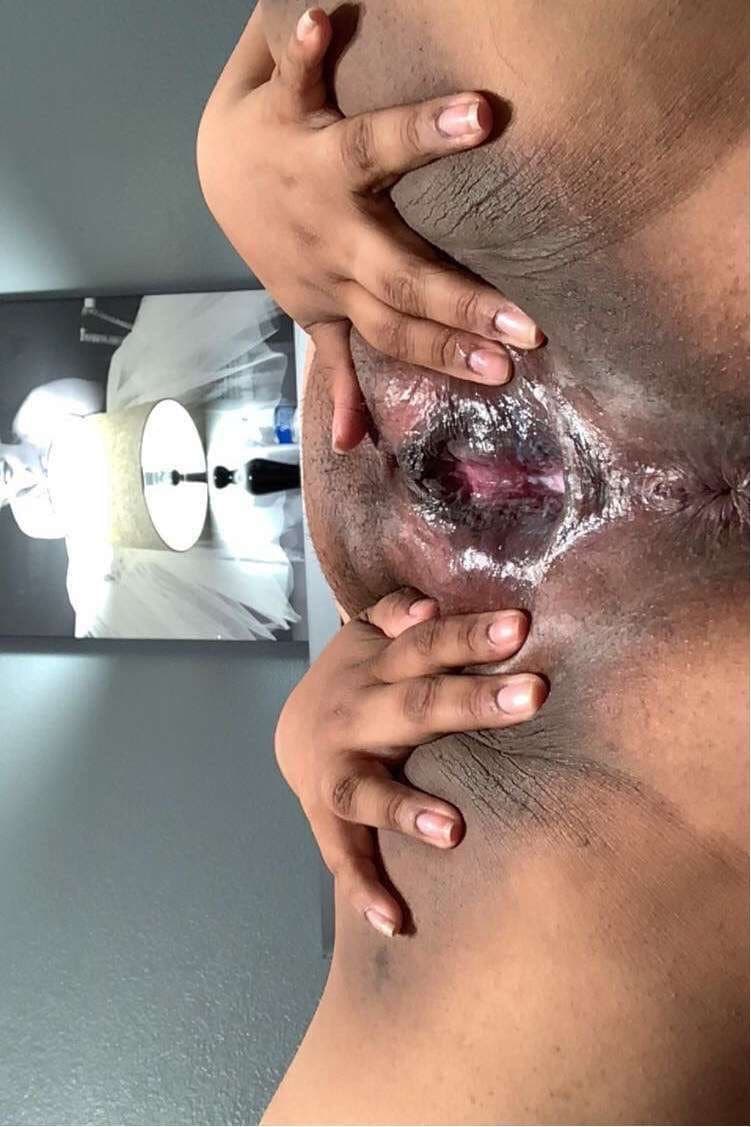 More of my dark fat pussy but pink in the inside of my fat dark pussy slit