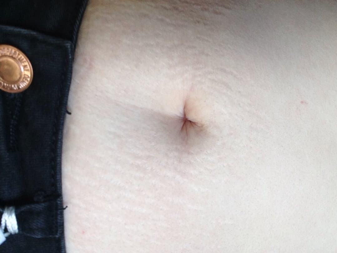 Emily scuderi aka twixie scuderi aka twixiepuppy old nude pics part 2