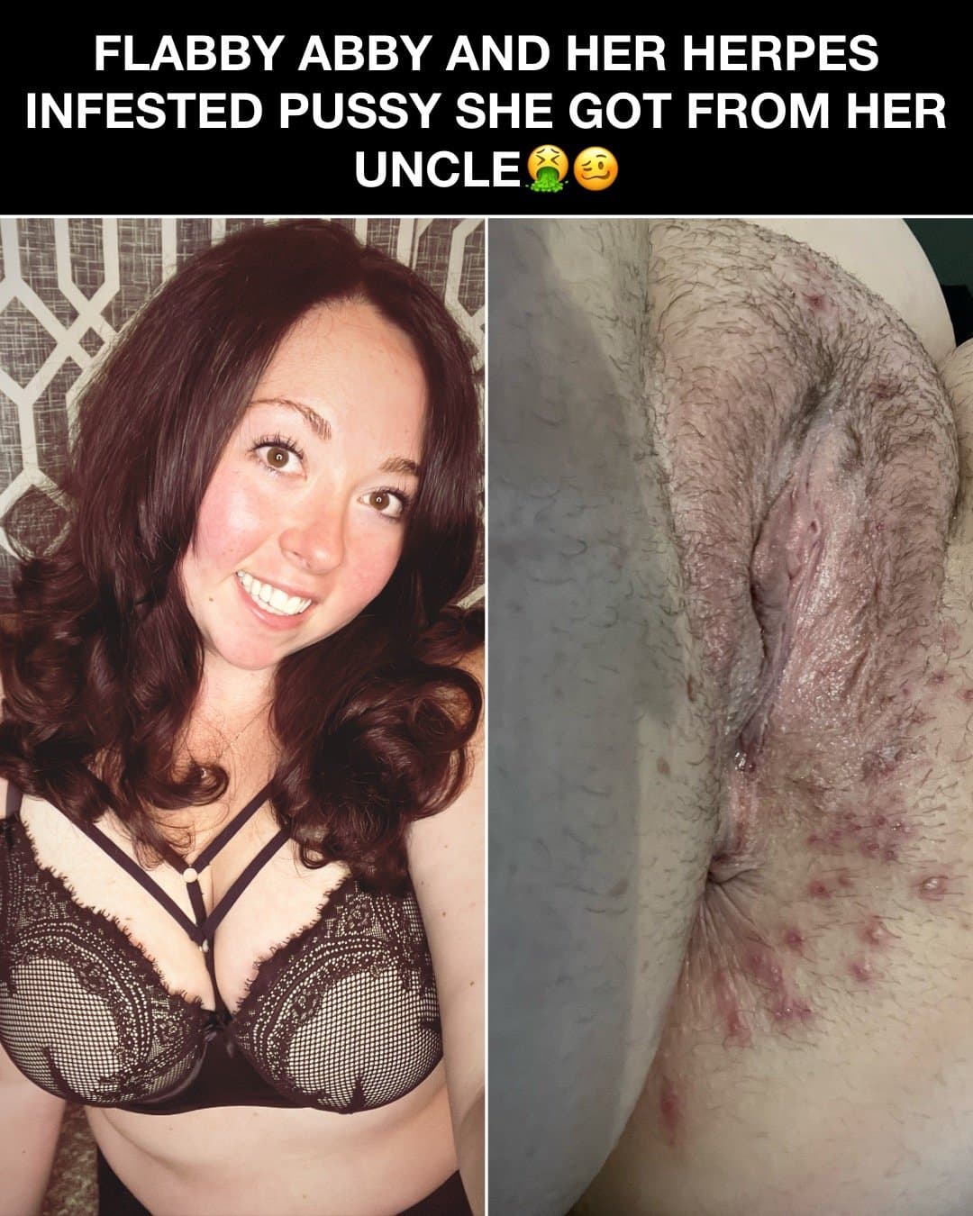 Click to view full size Flabby Abby bred by her Uncle!! Kik: mygirl4usecny